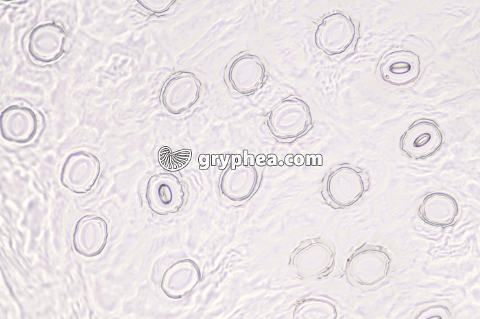 Stomates d'une feuille de Lierre - vue de la face inférieure (abaxiale) x60 - gryphea.com